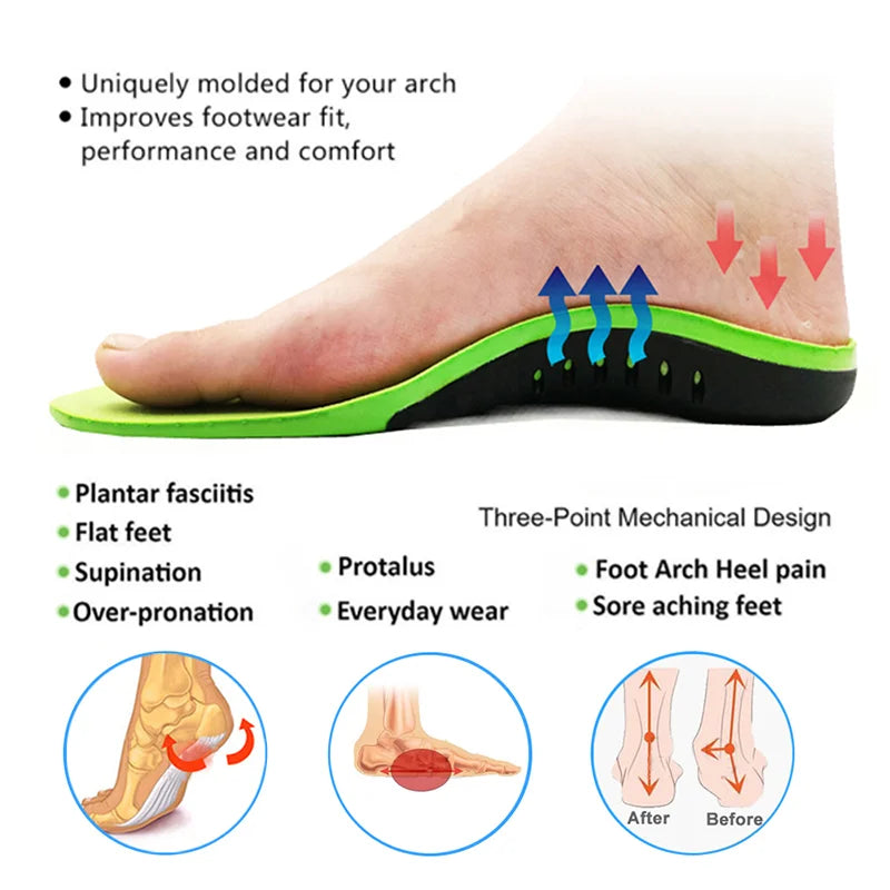 Orthopedic Insole Unisex Outdoor Hiking Travel Essentials X/o Leg Correction Flat Arch Support Sports High Elastic Cushion